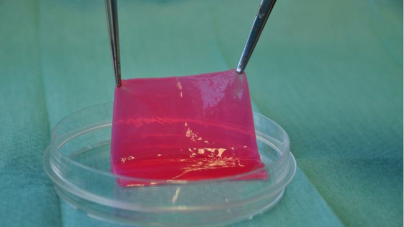 hauttransplantation-weniger-narben-dank-neuartiger-ersatzhaut-healthexperts-net